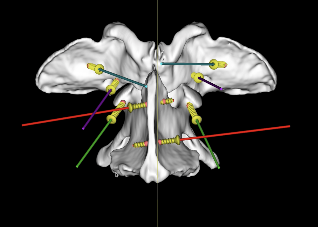 Pioneering Approach To Spinal Malformations In Dogs A Success For NDSR Specialist