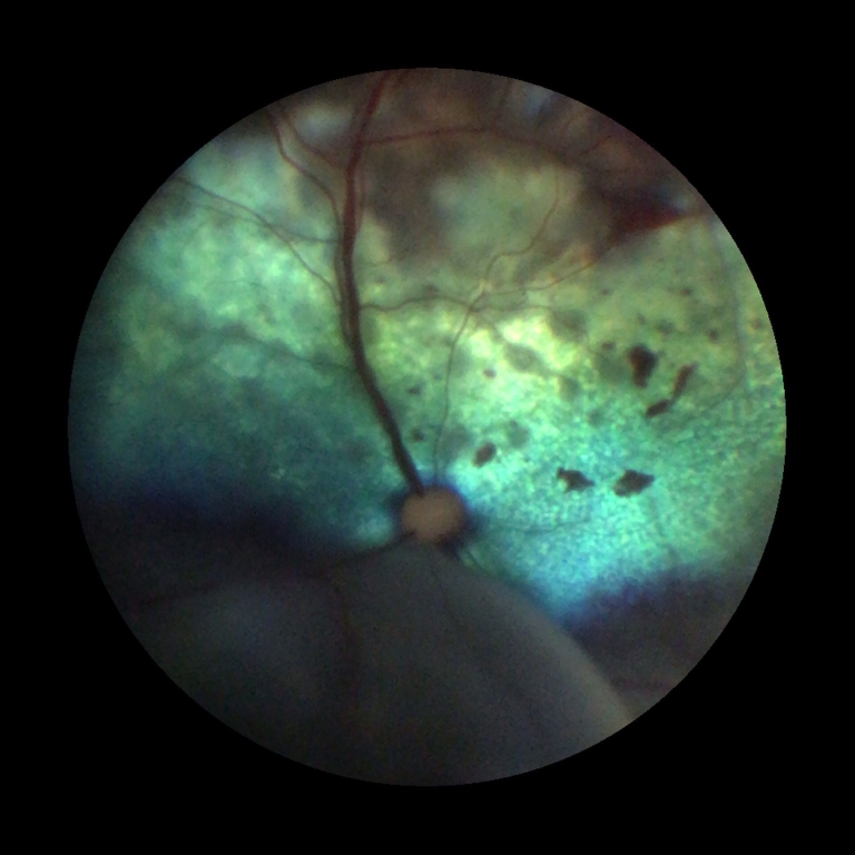 State-Of-The-Art Eye Camera Opens New Opportunities At Willows